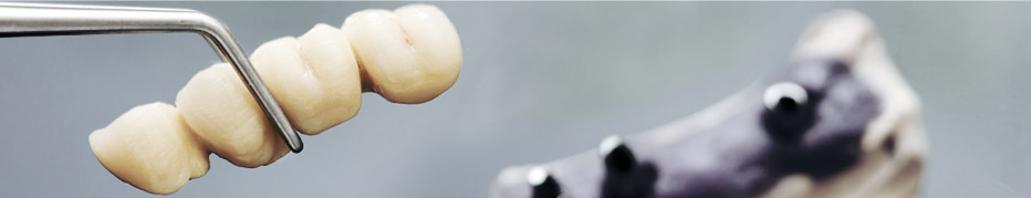 Protese Implantes
